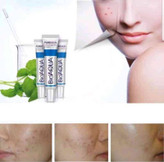 خرید و قیمت کرم ضدجوش بیواکوا